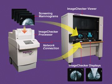 Computer-Aided Detection System for Digital Mammograms