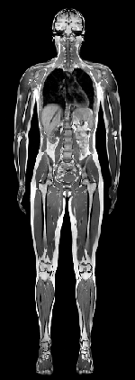 MRI of the entire human body
