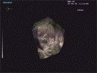 3D ultrasound image showing soft tissue of the fetal face