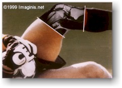Football (soccer) players knee